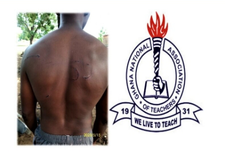 GNAT Demands for justice over the Brutalization of Students And A Teacher of St. Bernadette's Training Institute by police Officials. What A near death Situation. Check out the Video from this Poor Teacher.