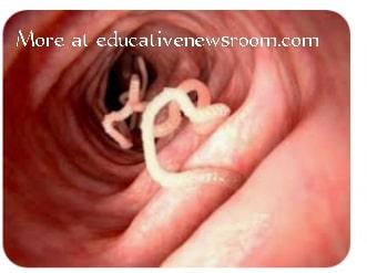 Intestinal worms